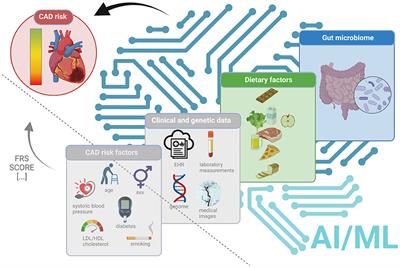 Could Artificial Intelligence/Machine Learning and Inclusion of Diet-Gut Microbiome Interactions Improve Disease Risk Prediction? Case Study: Coronary Artery Disease